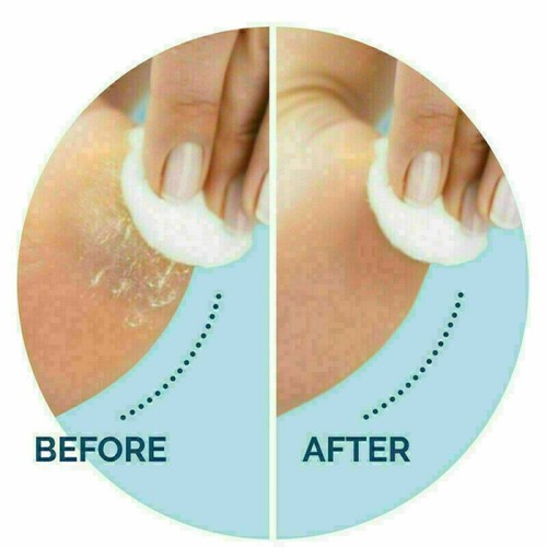 New Electric Foot File Hard Skin Remover Scholl Velvet Smooth Diamond crystals - Picture 5 of 11