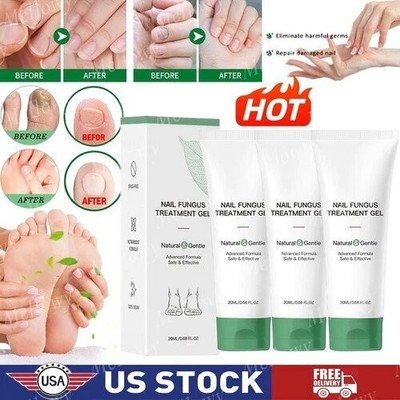 1/3X Nutraboost Nail Fungus Treatment Gel,Multi-Purpose Nail Repair Oil Serum US