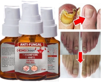 HONGO MAN HONGOSAN CORP ANTI FUNGAL Support EXTRA STRENGTH TOENAIL FUNGUS FUNGI SP NAIL ATHLETE'S FOOT