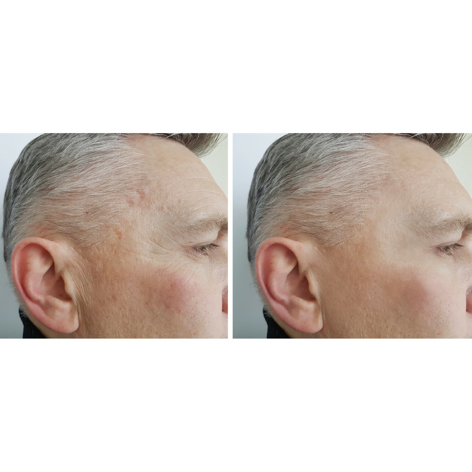 IMMACULIFT Instant Eye Lift Serum, Instant Facelift for ...