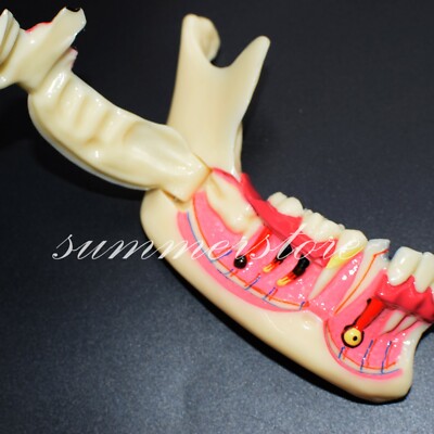 Dental Mandibular Tissue Root Nerve Anatomical Demonstration Teach Teeth Model