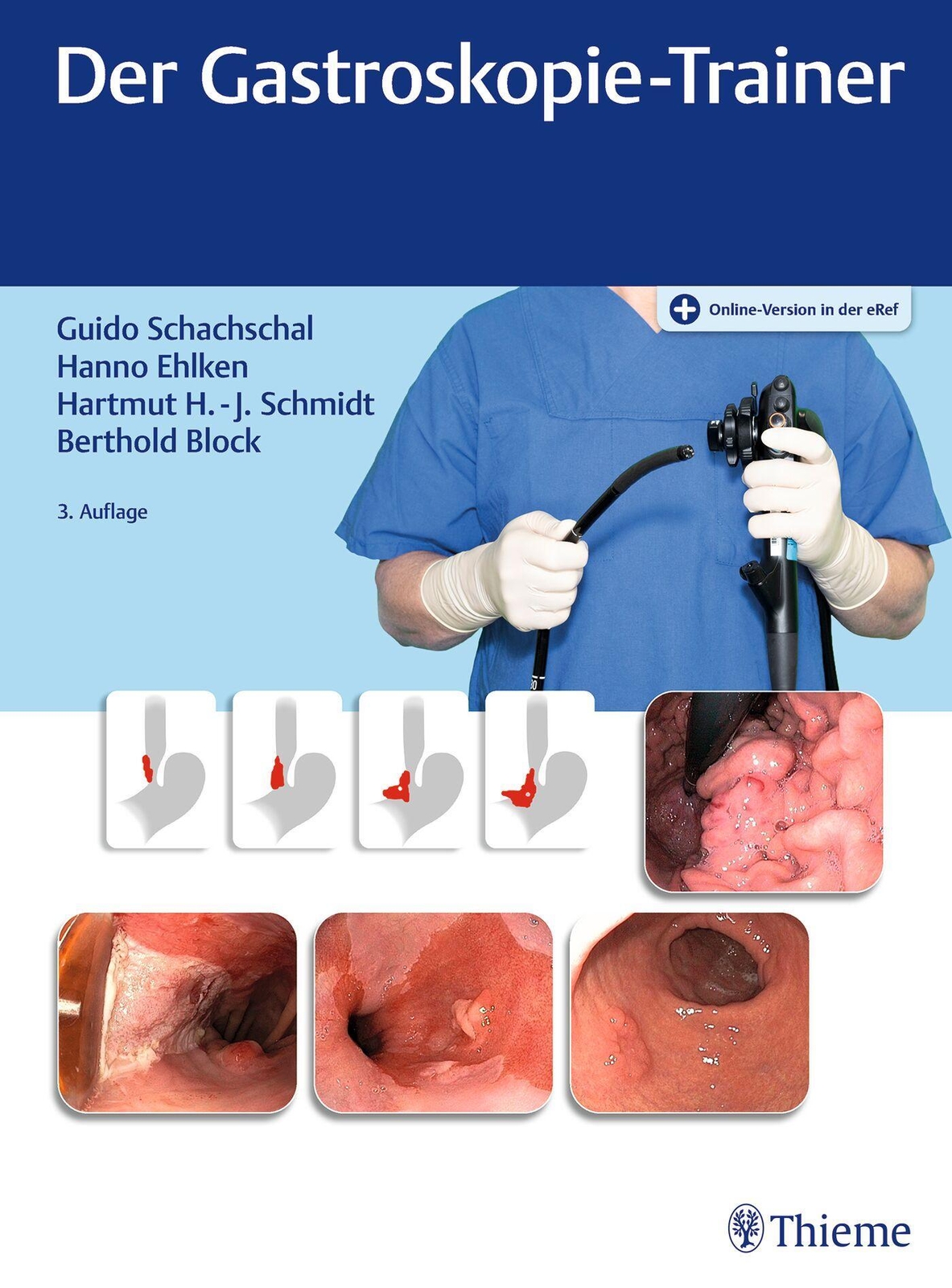 Thumbnail - Der Gastroskopie-trainer | Guido Schachschal (u. A.) | Bundle | Mixed