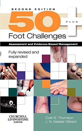 50+ Foot Challenges: Assessment and Evidence-Based Management-Co