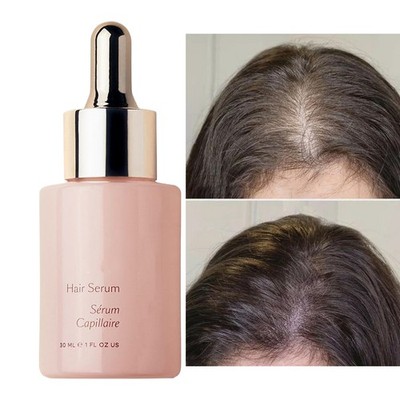 Vegamour GRO Scalp Serum 1 fl oz 30ml Hair Growth Treatment for Thinning Hair