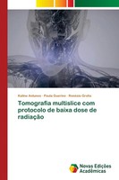 Tomografia Multislice Com Protocolo De Baixa Dose De RadiaçãO Antunes (U. A.)