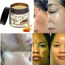 Beef Tallow for Skin - Organic Grass-Fed Whipped Beef Tallow and Honey Balm 7oz