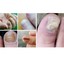 thumbnail 10 - Nail Fungal Treatment Pen Anti Fungus Infection Biological Repairs Solution Care