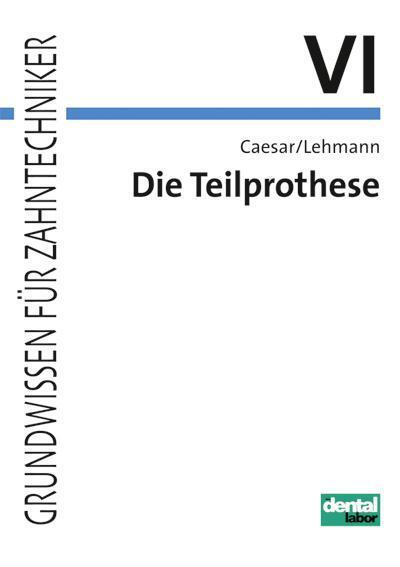 Thumbnail - Die Teilprothese H Hans Caesar, Klaus M Lehmann