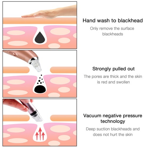 Máquina exfoliante de piel facial hidroexfoliante chorro de oxígeno y agua pequeñas burbujas - Imagen 5 de 12