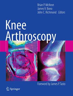 Knee Arthroscopy - [Springer Nature]