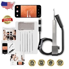 Visual Blackhead Remover Tweezers w/ HD Camera 1080P 20x Magnification