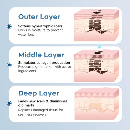 Advanced Silicone Scar Gel for Face & Body Acne Surgery Burn Injuries C-Section - Picture 5 of 7