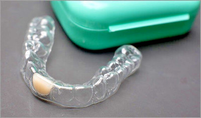 RESTORE YOUR SMILE with Essex Replacement Tooth- Custom Fit &Affordable!