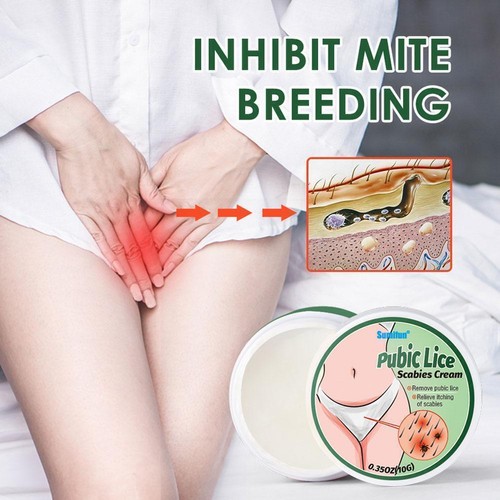 Pubic Lice Scabies Cream Antibacterial Lice Removal Anti-mite Care Ointment S1G3 - Picture 4 of 9