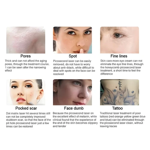 Pico ND YAG Laser Machine For Tattoo Removal Skin Whitening And Rejuvenation image 10