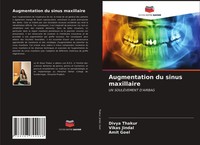 Divya Thakur (U. A.) | Augmentation Du Sinus Maxillaire | Taschenbuch (2021)