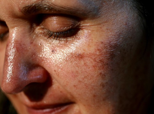 Crema facial de limón | Iluminador y control de manchas persistentes|400 - Imagen 15 de 19
