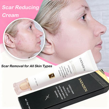 Acne Scar Treatment Acne Scar Cream for Face for Stretch Marks and Body Scars