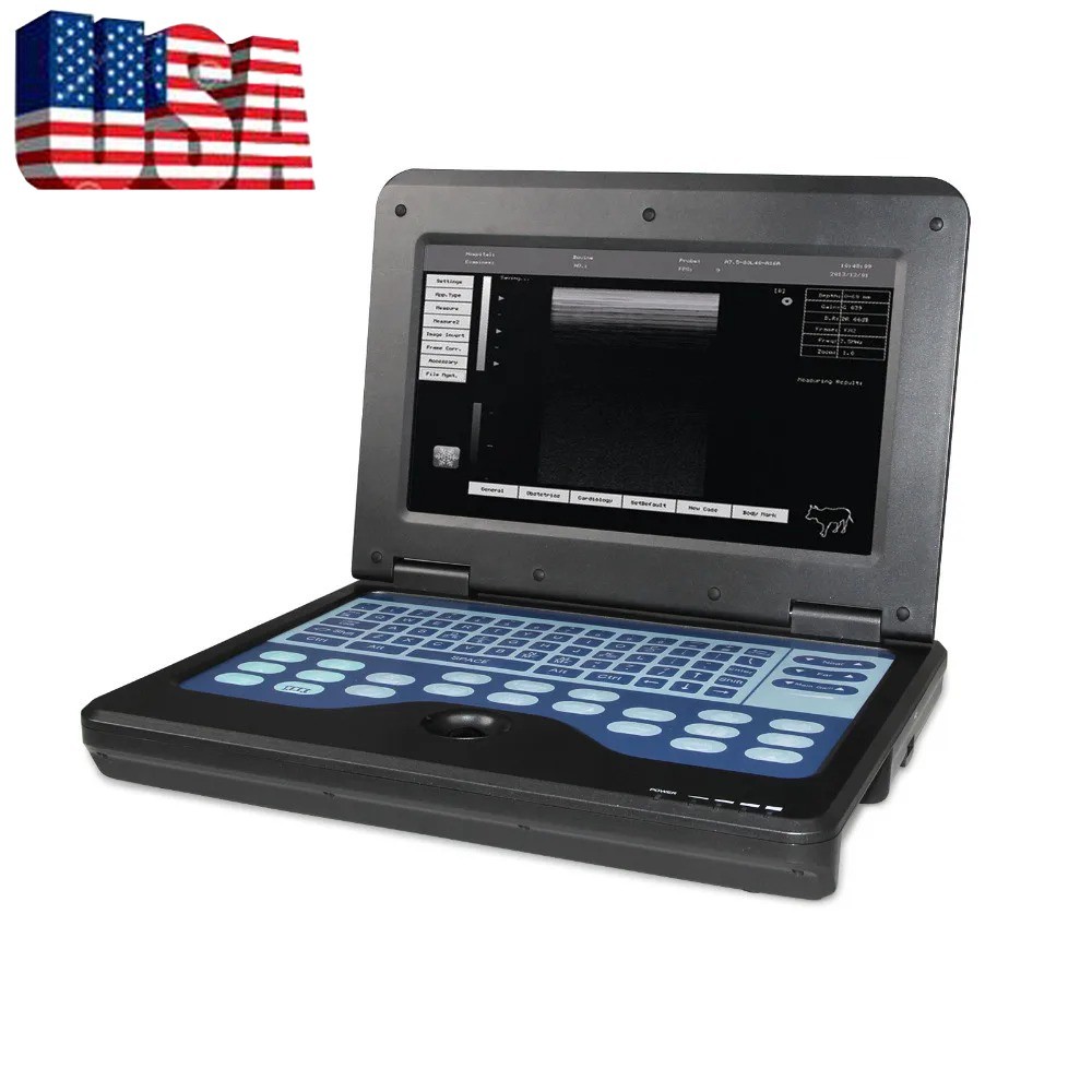 CMS600P2 Portable Ultrasound Scanner Clinical Medical Machine for Diagnosis