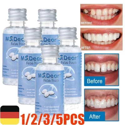 MS.DEAR 5/3x Zahnreparaturperlen Zahn Reparatur Set Zahnperlen Zahnersatz Provisorischer