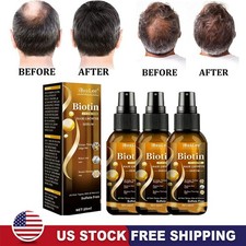 5x Biotin Hair Growth Spray Anti Hair Loss Fast Regrowth Scalp Treatment Serum