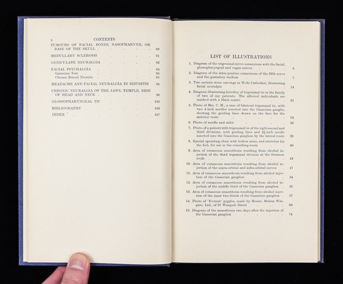 The Facial Neuralgias by Wilfred Harris 1937 Oxford Medical Publication - Picture 9 of 16