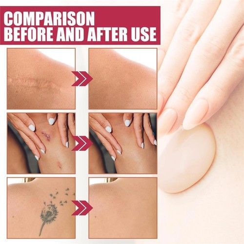 Body Makeup Waterproof Foundation, Leg Makeup For Varicose Veins Waterproof - Picture 15 of 18