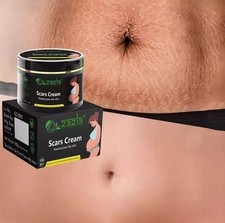 Best Scar Removal-Cream for Old-Scars Stretch Mark Removal Cream UNISEX 100g
