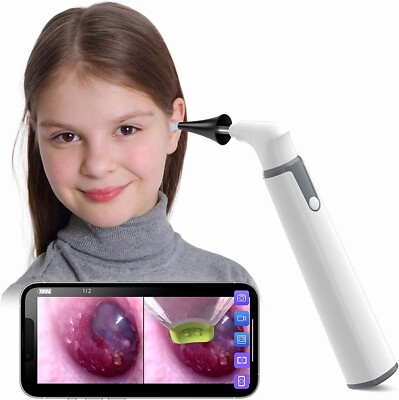 Wireless Otoscope Ear Camera with Dual View, 3.9Mm 720PHD Wifi Ear Scope 6 LED
