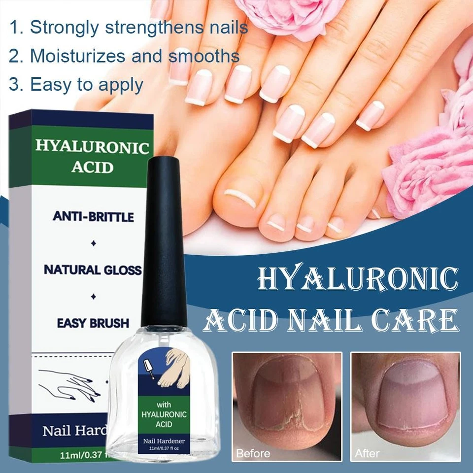 Nail Strengthener Oil Promote Growth Repair Brittle Discolored Nail Hand Foot↥