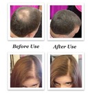 VIKADA Hair Fibers Hair Keratin Powder Hair Building Dark Brown 2 Bottles 27.5g — photo 8