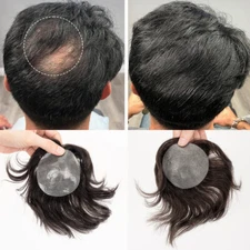 Lace PU Skin Base Bald Spot Hair Patch For Mens Remy Human Hair Patch Hairpieces