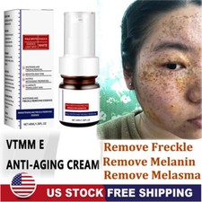 Effective Whitening Freckle Cream Remove Dark Spot Cream Removal Melanin Melasma