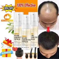  Halo Grow Hair Growth Spray, with Rosemary Biotin Ginseng for Hair Loss 60ml US