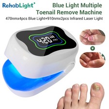 Multiple Toenail Fungus Treatment Nail Fungus Laser Treatment for Onychomycosis