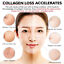 thumbnail 5  - 30g Whitening Cream Retinol Gel Removes Melasma Acne Spots pigment dark spots UK