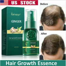 Hair Growth Serum Spray Hair Regrowth Ginger Essence Oil Anti Loss Treatment US