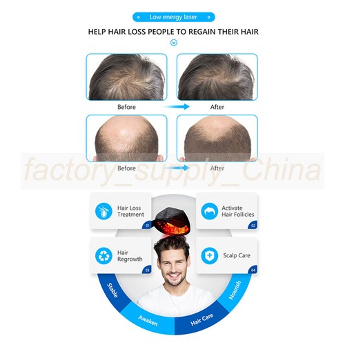 Laser Light Hair Growth Cap Hair Loss Treatment Device Regrowth Therapy - Picture 6 of 12