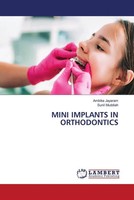 Ambika Jayaram (U. A.) | Mini Implants IN Orthodontics | Taschenbuch | Englisch