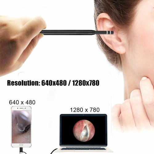 3 in 1 HD Ohr Reinigung USB Endoskop Ohrstocher mit Kamera HD Ohrenschmalz Entfernung Kit - Bild 7 von 12