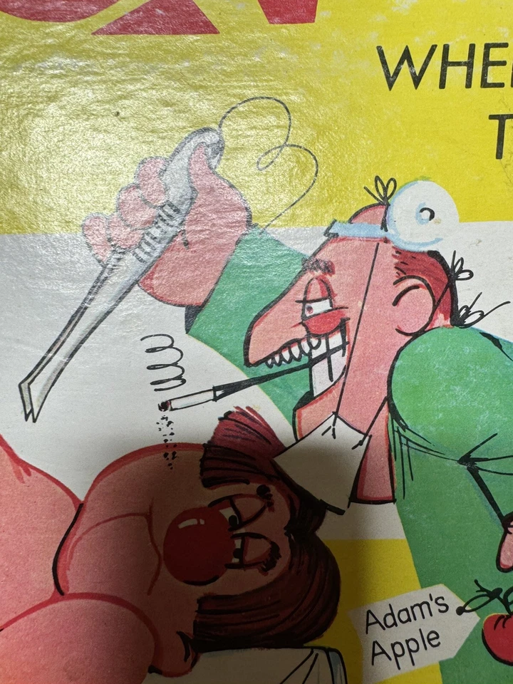 VTG Smoking Doctor Version w/ Barcode Milton Bradley Operation Game Incomplete - Image 3 of 4