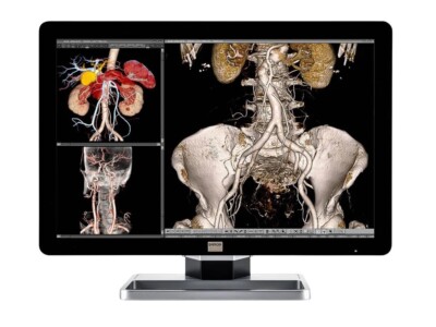 Barco MDCC-6230 6MP 30