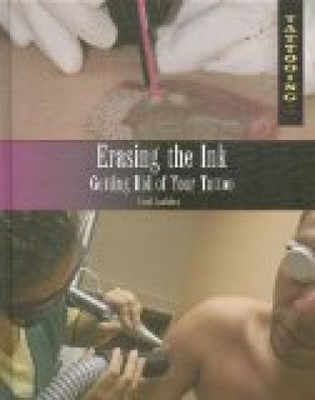 Erasing the Ink: Getting Rid of Your Tattoo (Tattooing) Spalding, Frank:
