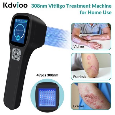 308nm Excimer Therapeutic Light Therapy Phototherapy Device For Skin Diseases