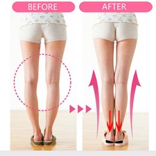 1Pair O-type Leg Bow-legged Corrective Shoes Inserts Orthopedic Pad Insoles Mats