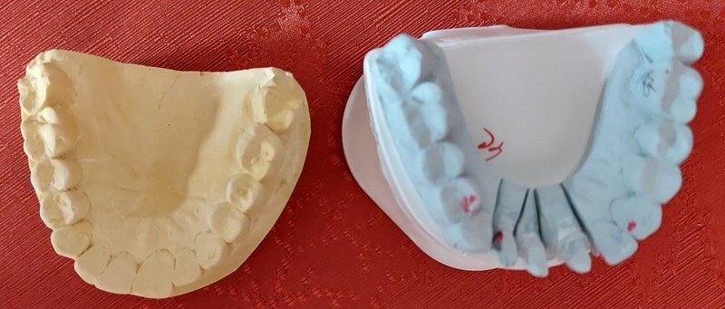 GENUINE Plaster Dental Molds Teeth Mouth Cast Medical Oddity Oddities Halloween 