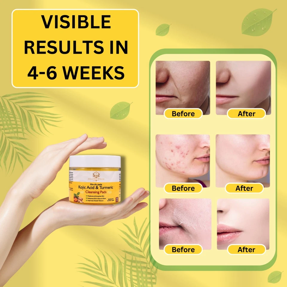 Almohadillas faciales de cúrcuma de ácido kójico | Vitamina C B5 | 50 almohadillas Foto 4 de 4