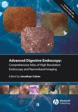 Comprehensive Atlas of High Resolution Endoscopy and Narrowband I
