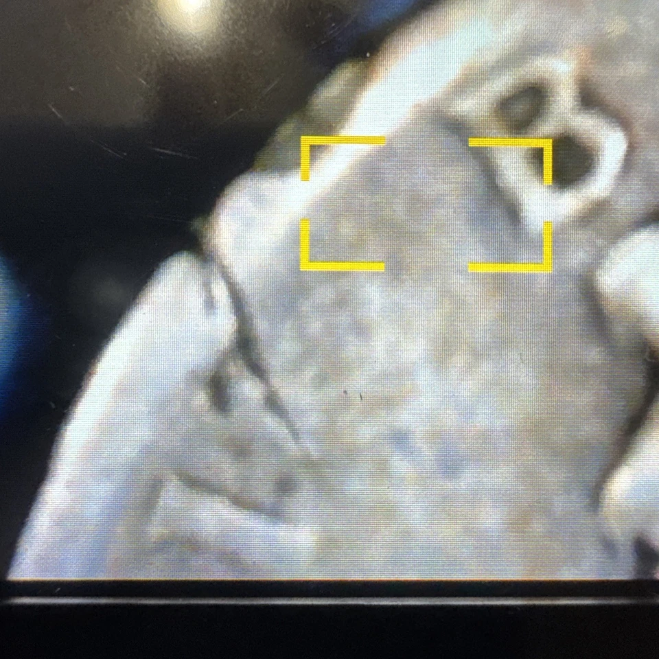 1926-S Mercury Head Dime That Has Cracks And Chips Around The Rim Of The Coin - Image 3 of 4