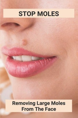 Stop Moles: Removing Large Moles From The Face: Surefire Way To Get Rid Of Moles